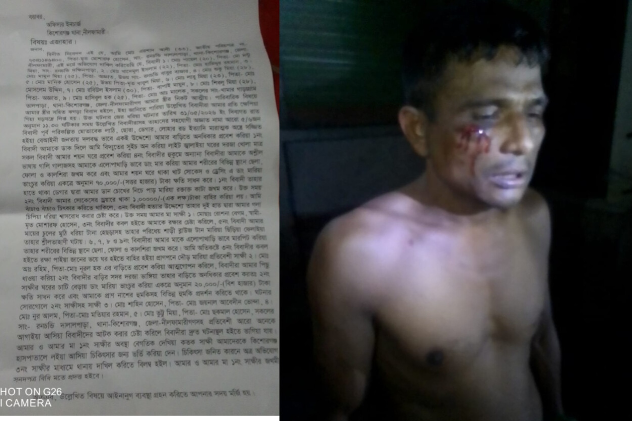 স্ত্রীকে কেন্দ্র করে বিরোধের জেরে বাড়িতে হামলার অভিযোগ, আহত ২