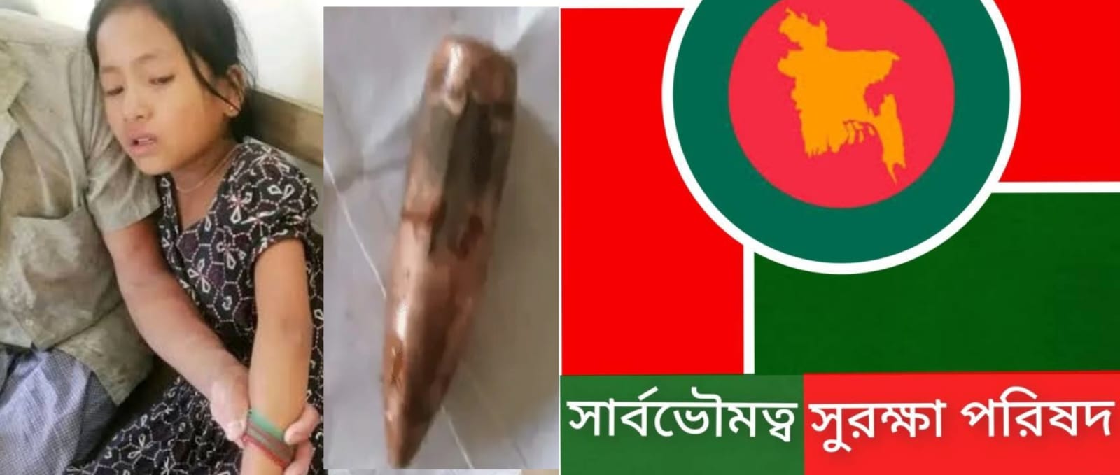 সাজেকে দফায় দফায় গোলাগুলি, গুলিবিদ্ধ ৯ বছরের শিশু সঞ্জিতা;সার্বভৌমত্ব সুরক্ষা পরিষদের প্রতিবাদ